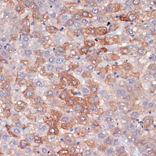 Hemopexin (HPX) Rabbit mAb