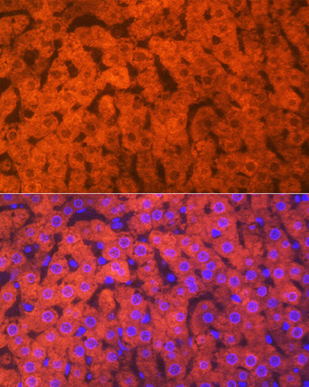 Hemopexin (HPX) Rabbit mAb