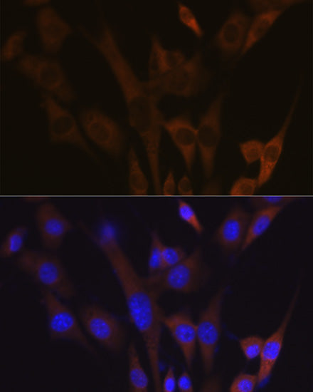 ABCE1 Rabbit mAb