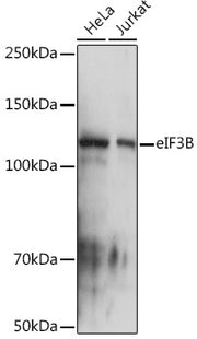 eIF3B Rabbit mAb