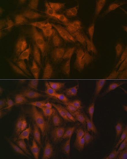 eIF3B Rabbit mAb
