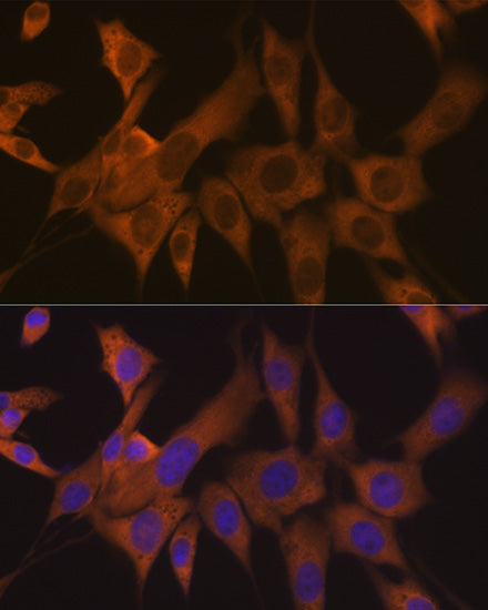 eIF3B Rabbit mAb