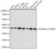 Prohibitin 2 (PHB2) Rabbit mAb