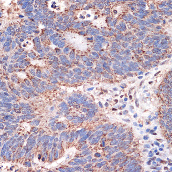 Prohibitin 2 (PHB2) Rabbit mAb