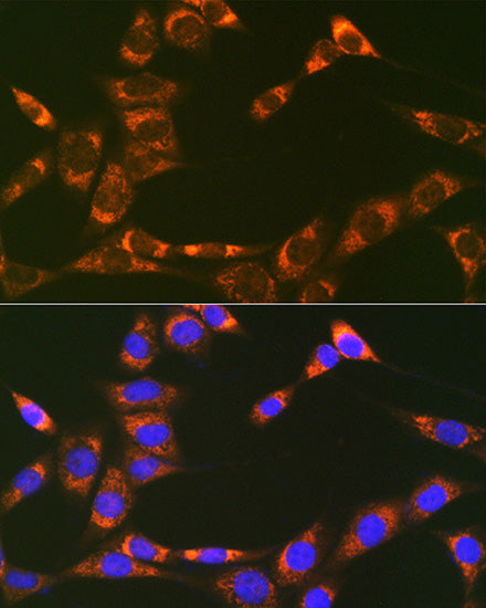 Prohibitin 2 (PHB2) Rabbit mAb