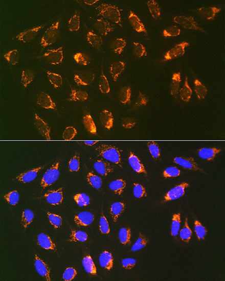 Prohibitin 2 (PHB2) Rabbit mAb