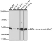 GABA transaminase (ABAT) Rabbit mAb