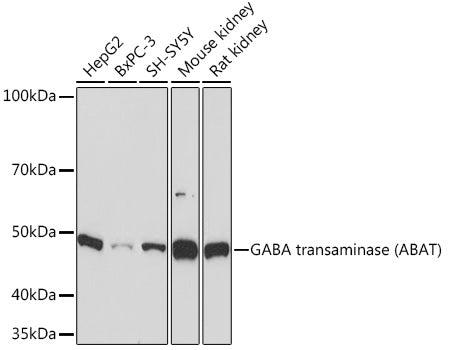 GABA transaminase (ABAT) Rabbit mAb