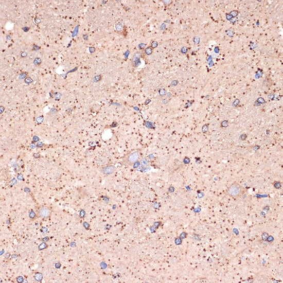 GABA transaminase (ABAT) Rabbit mAb