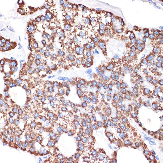 GABA transaminase (ABAT) Rabbit mAb