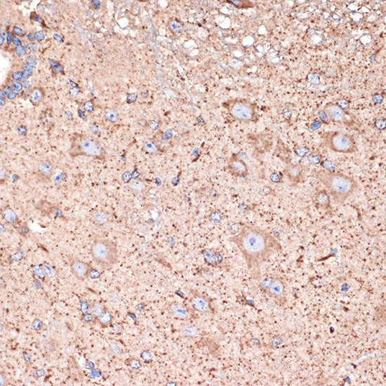 GABA transaminase (ABAT) Rabbit mAb