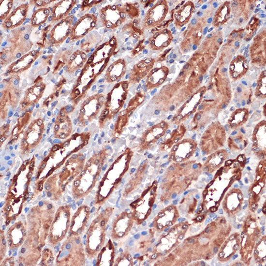 Carbonic Anhydrase 2 (CA2) Rabbit mAb