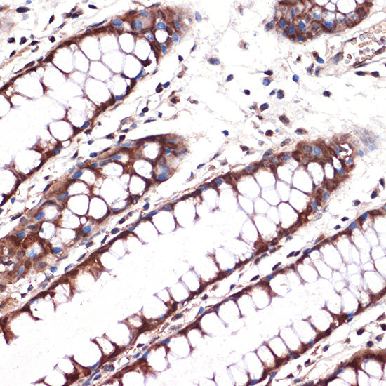 Carbonic Anhydrase 2 (CA2) Rabbit mAb