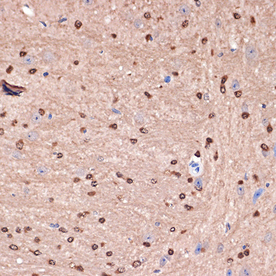 Carbonic Anhydrase 2 (CA2) Rabbit mAb