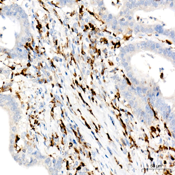 CD74 Rabbit mAb
