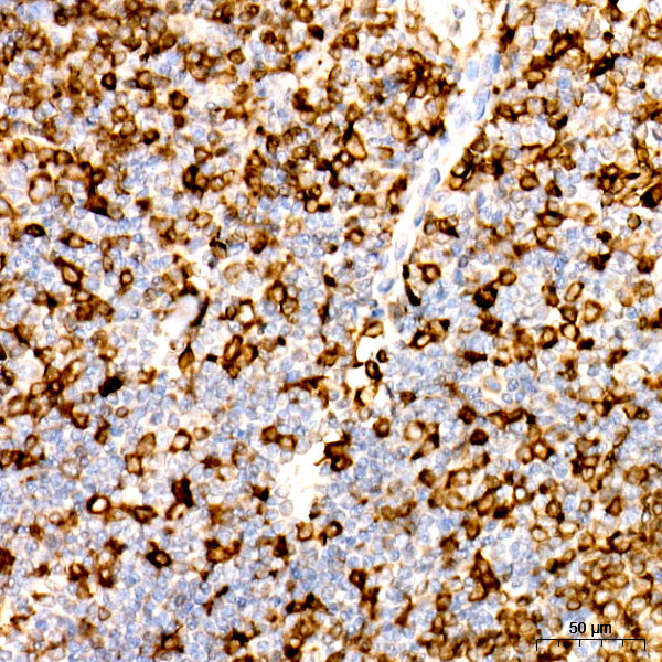 CD74 Rabbit mAb