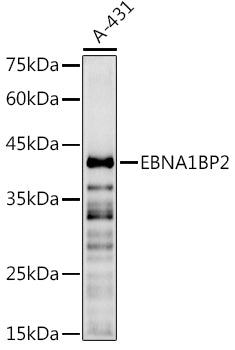 EBNA1BP2 Rabbit pAb