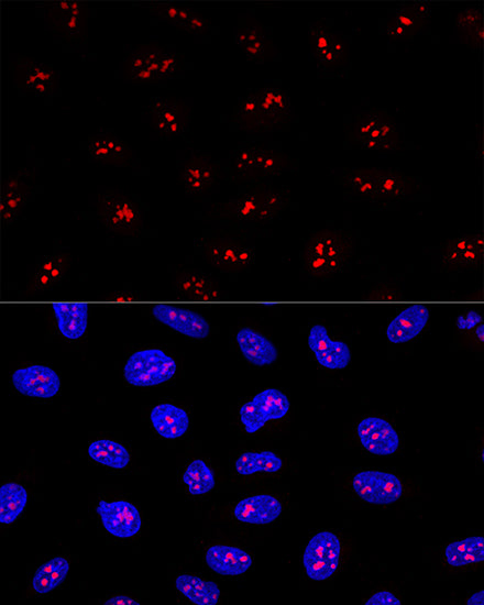 EBNA1BP2 Rabbit pAb