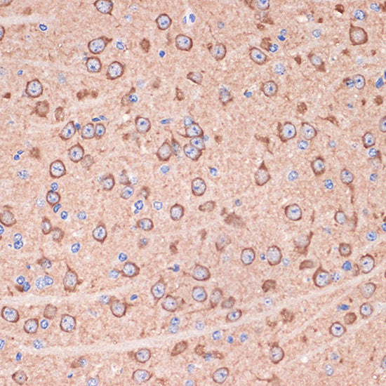 14-3-3 gamma Rabbit mAb