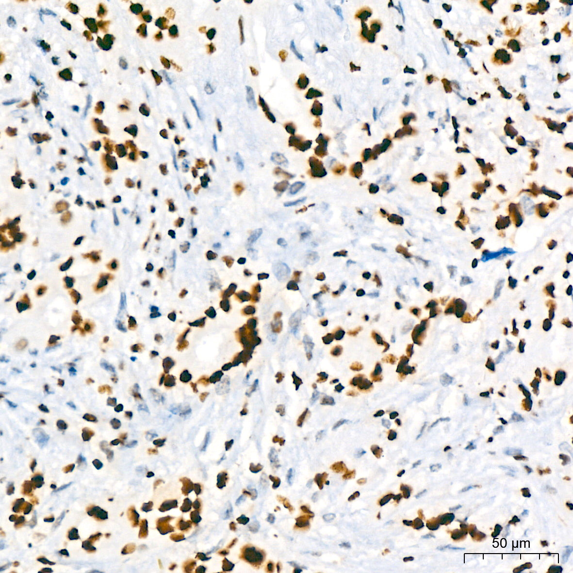 HMGB2 Rabbit mAb