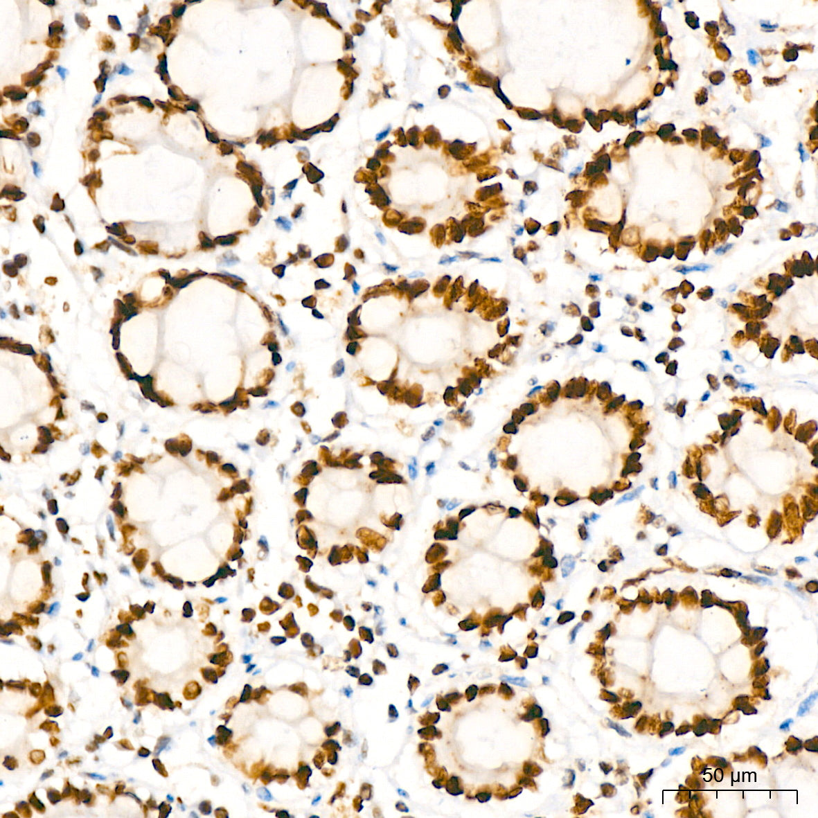 HMGB2 Rabbit mAb