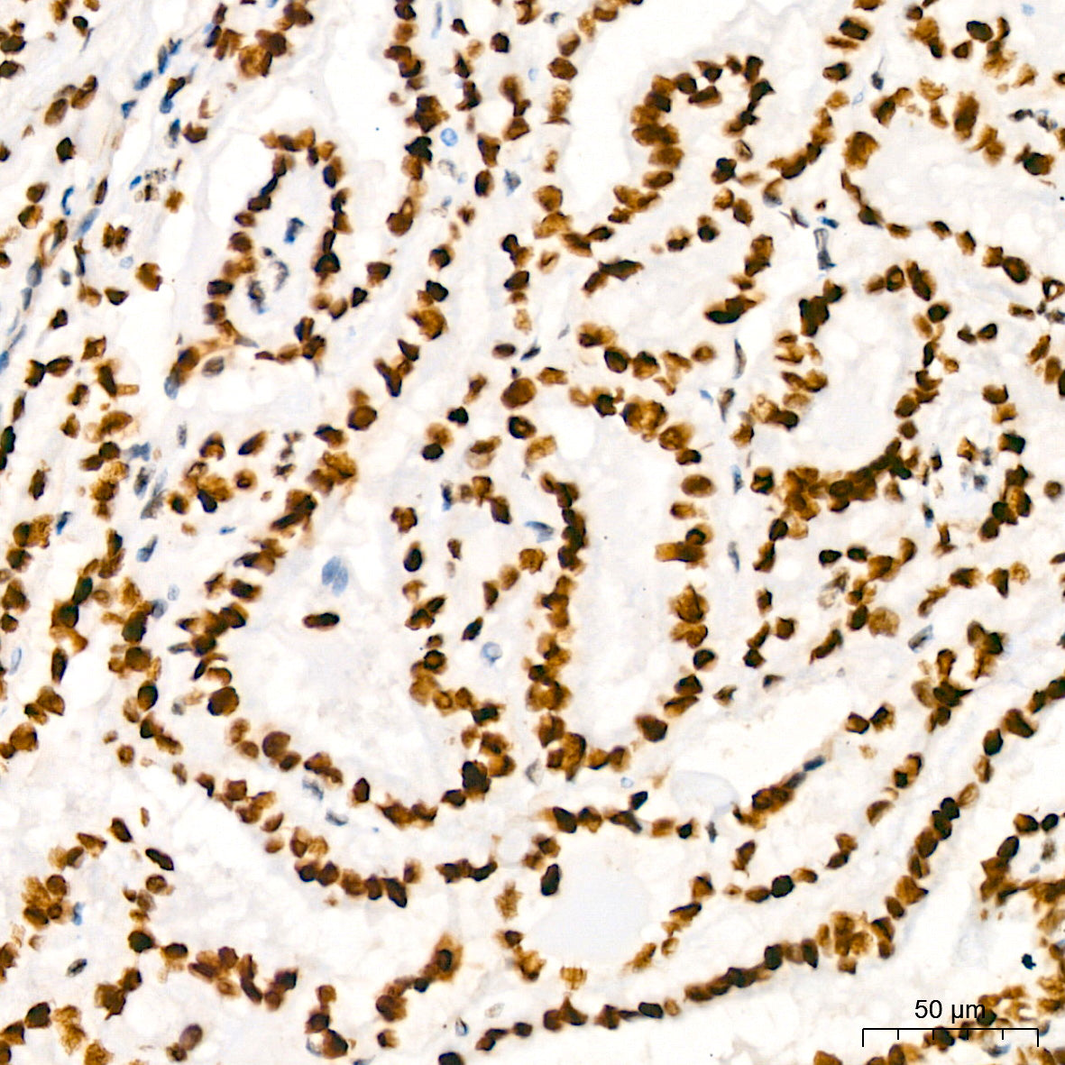 HMGB2 Rabbit mAb