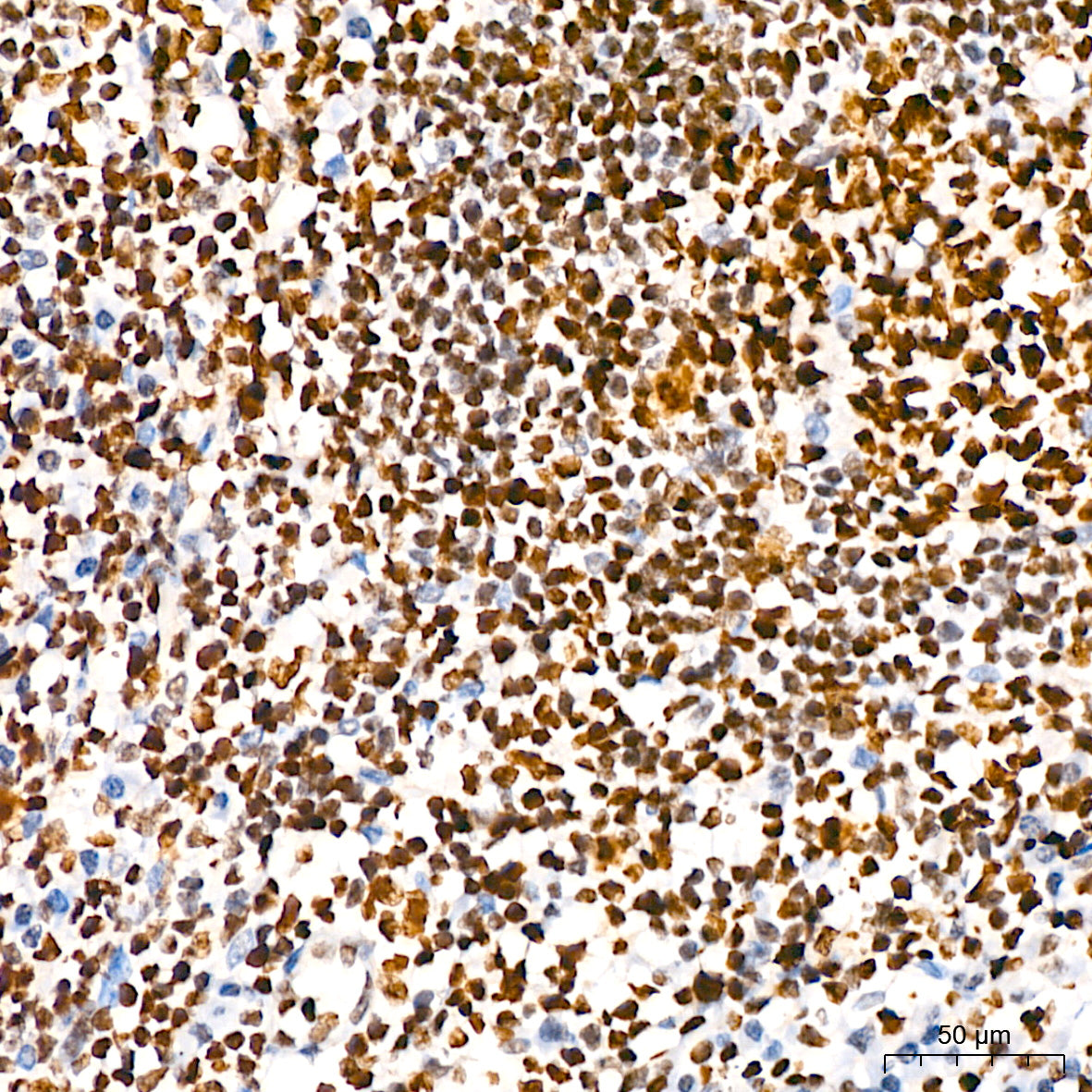 HMGB2 Rabbit mAb