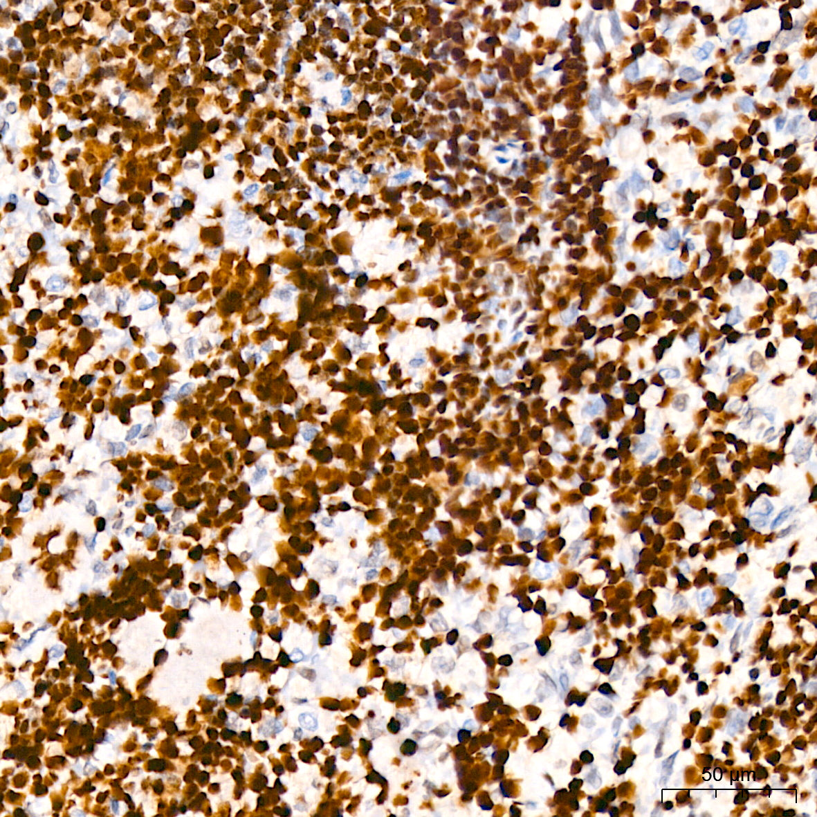 HMGB2 Rabbit mAb