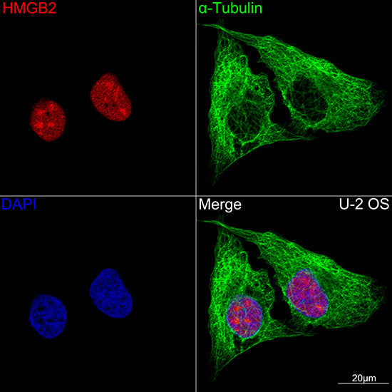 HMGB2 Rabbit mAb