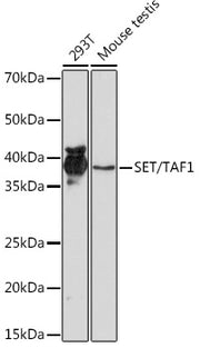 SET/TAF1 Rabbit mAb
