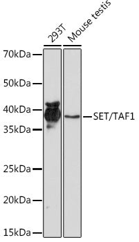 SET/TAF1 Rabbit mAb