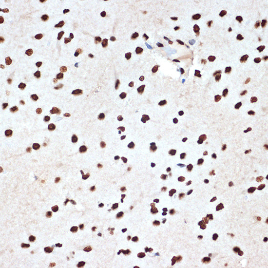 SET/TAF1 Rabbit mAb