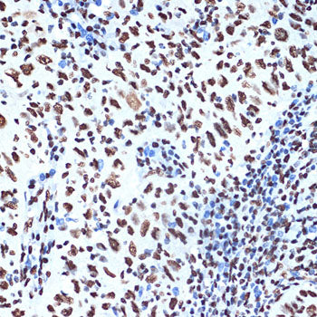 SET/TAF1 Rabbit mAb