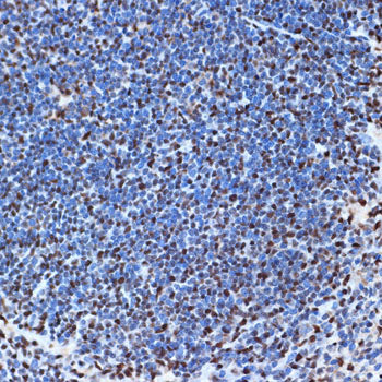 SET/TAF1 Rabbit mAb