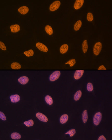 SET/TAF1 Rabbit mAb
