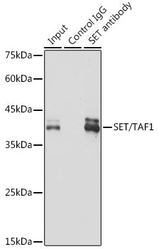 SET/TAF1 Rabbit mAb