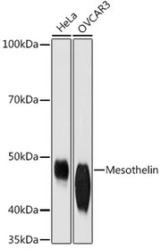 Mesothelin Rabbit mAb