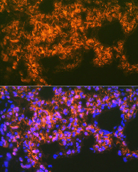 Mesothelin Rabbit mAb
