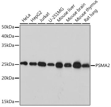 PSMA2 Rabbit mAb
