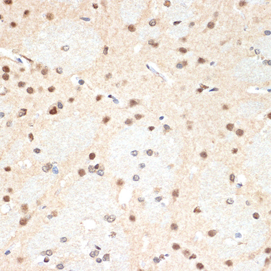 PSMA2 Rabbit mAb