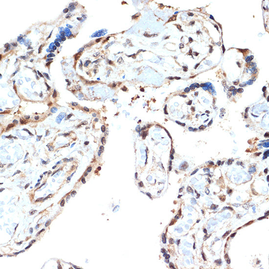 PSMA2 Rabbit mAb