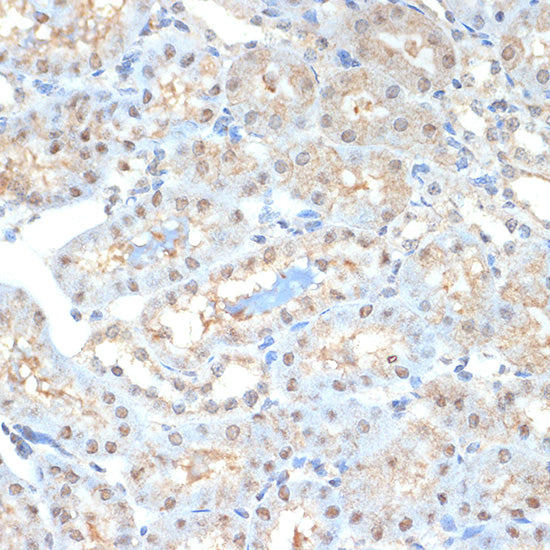 PSMA2 Rabbit mAb