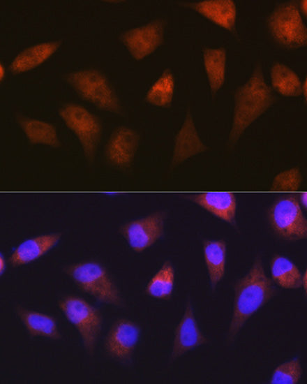 PSMA2 Rabbit mAb