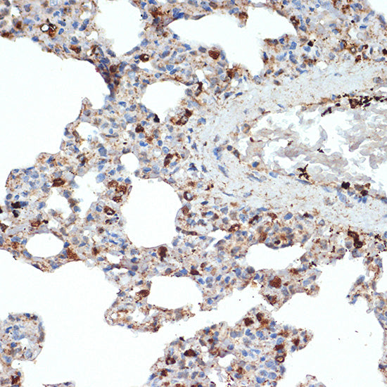 SR-B2/LIMPII Rabbit mAb