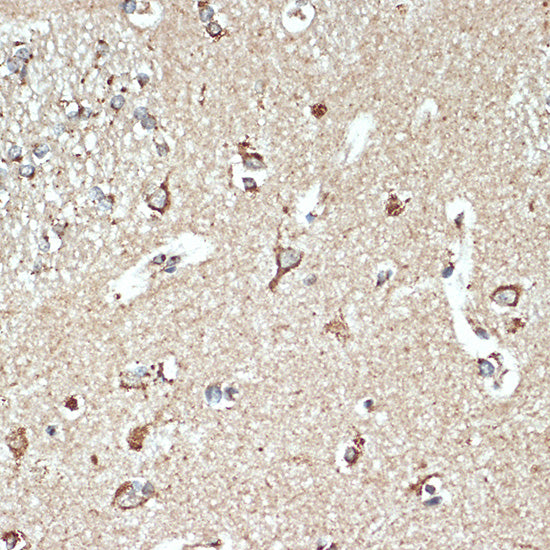 SR-B2/LIMPII Rabbit mAb