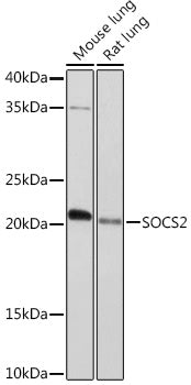 SOCS2 Rabbit mAb
