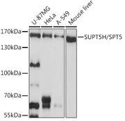 SUPT5H/SPT5 Rabbit pAb