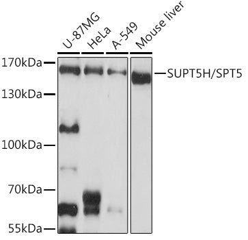 SUPT5H/SPT5 Rabbit pAb