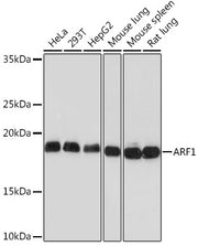 ARF1 Rabbit mAb