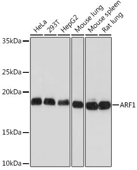 ARF1 Rabbit mAb